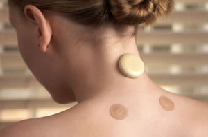 Stick-on magnets are often placed near acupuncture points.