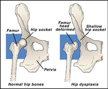 Dysplastic joints may come partly out of the socket when rotated through the whole range of motion of the hip. 